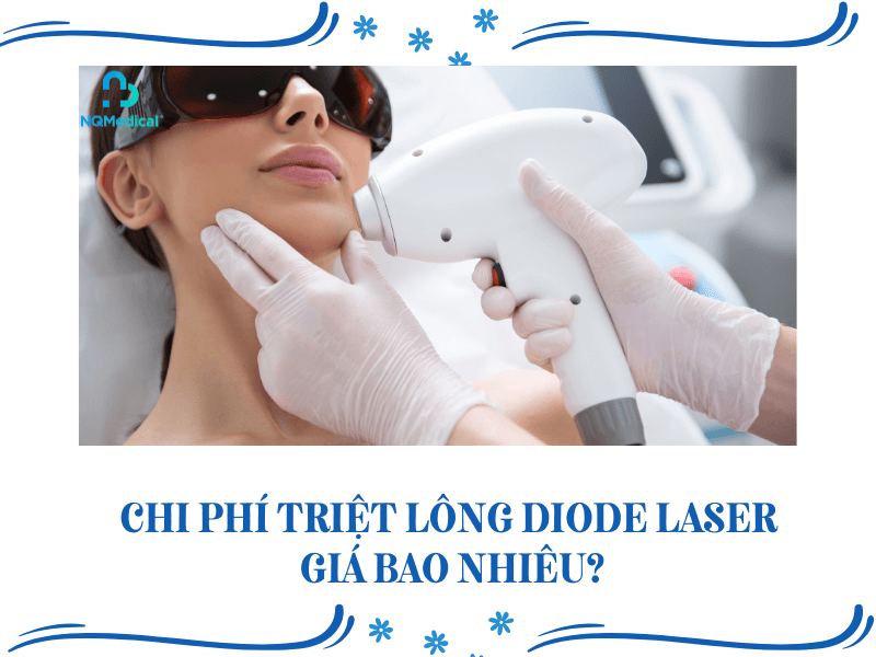 Công nghệ triệt lông Diode Laser 10