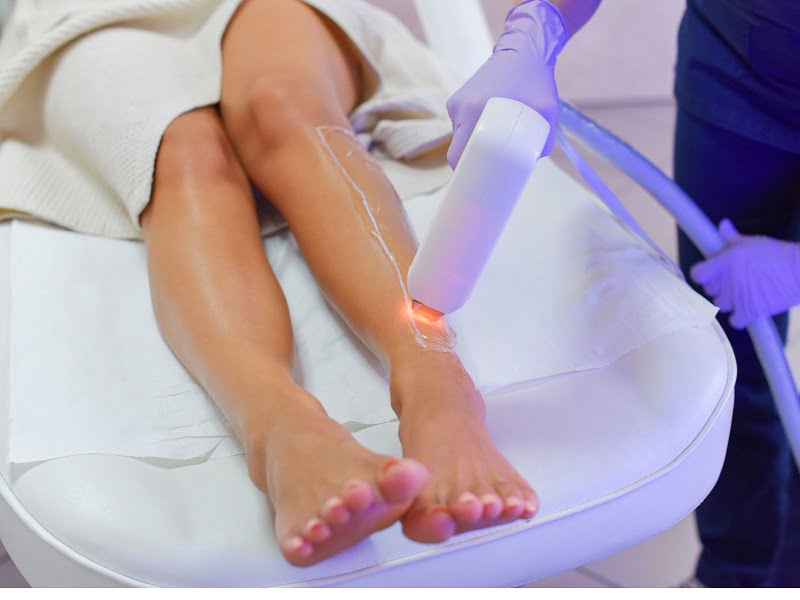 Công nghệ Diode Laser có thể sử dụng cho mọi vùng da nhờ vào khả năng làm mát nhanh chóng