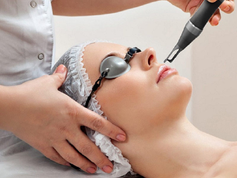 Bắn laser trị nám bao lâu thì hết - 1