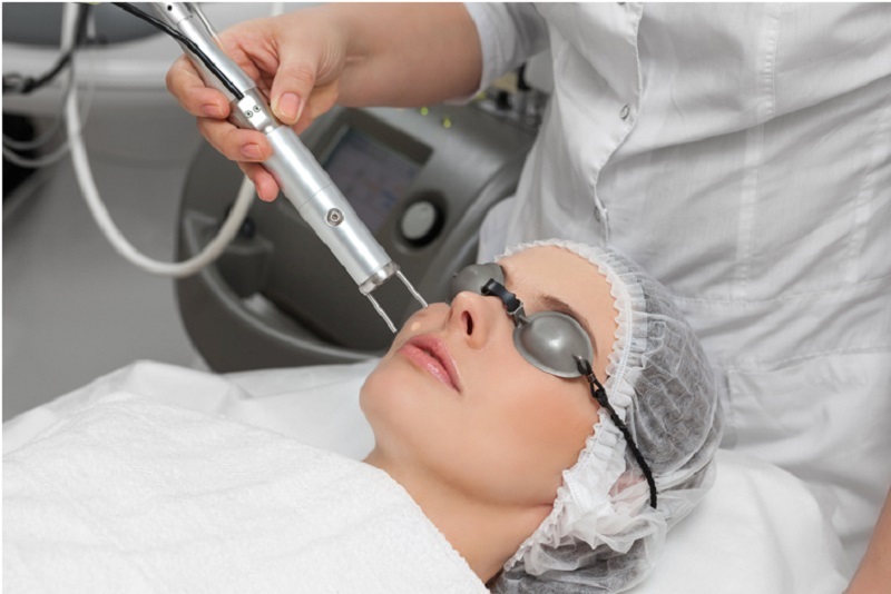 Bắn laser trị nám bao lâu thì hết - 4