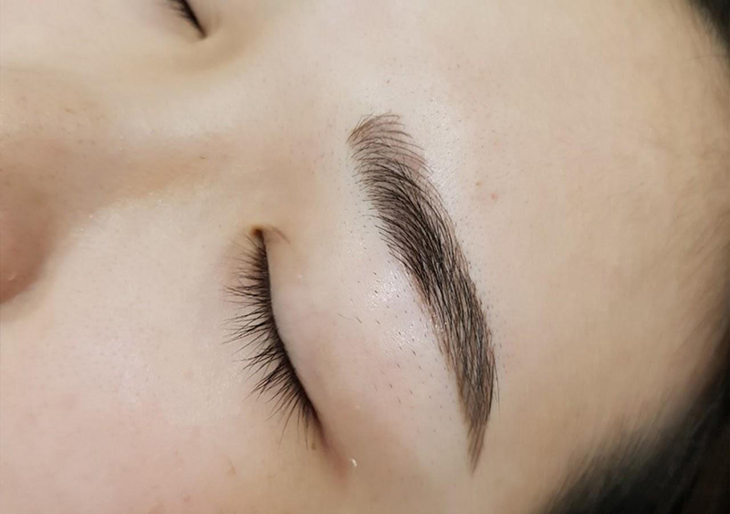 Sau khi xóa lông mày có thể gặp một số tổn thương nhỏ