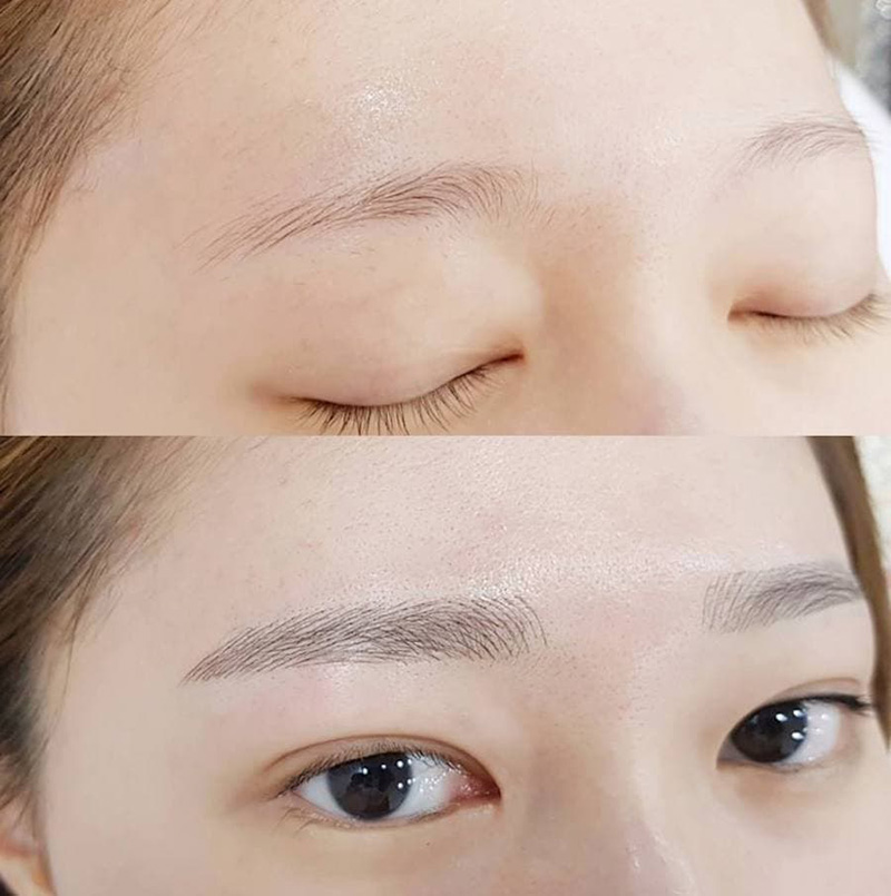 Dưới đây là 5 cách xóa xăm chân mày mà chị em chưa biết