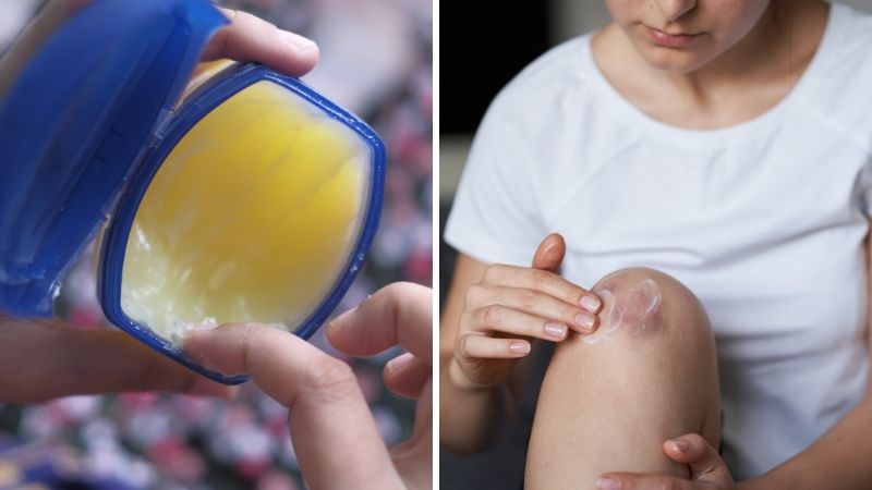 Cách trị thâm đầu gối bằng Vaseline - 3