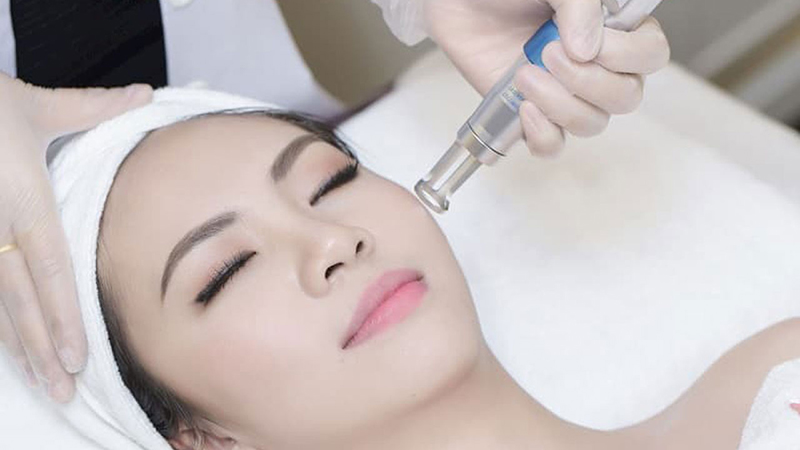 Trị nám bằng công nghệ Mela Extra không gây đau