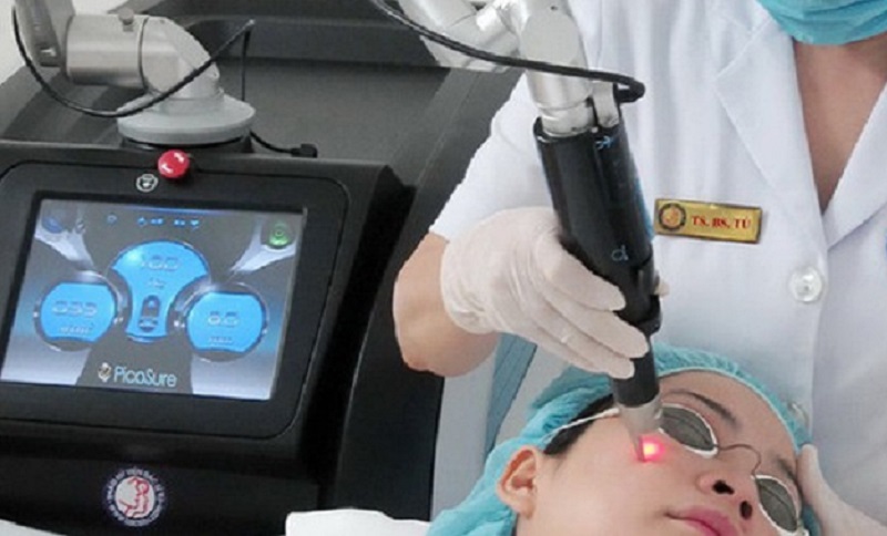 Công nghệ trị nám Picosure - 4