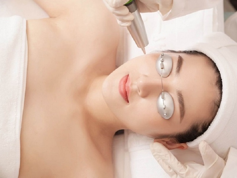 Công nghệ trị nám tốt nhất hiện nay - 2