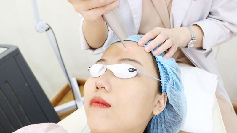 Công nghệ trị nám tốt nhất hiện nay - 3
