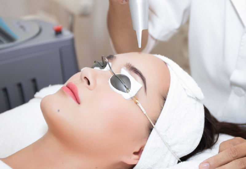 Công nghệ trị nám tốt nhất hiện nay - 4