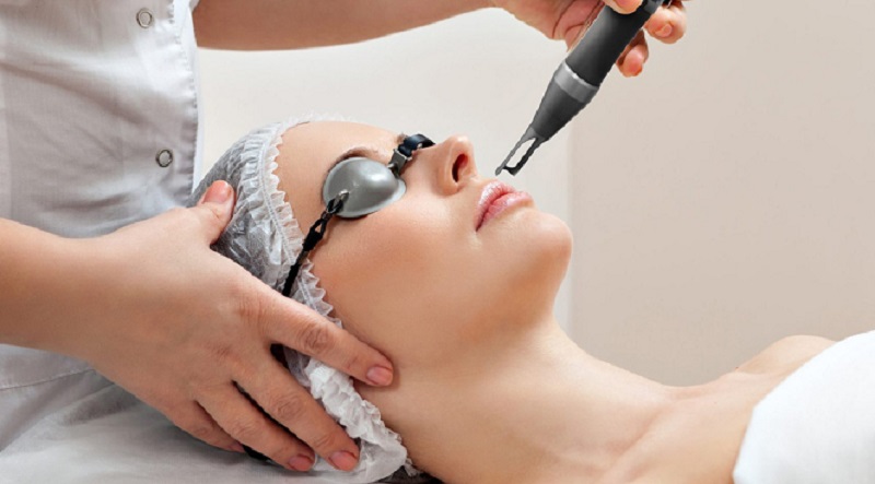 Máy laser trị nám tốt nhất hiện nay - 2