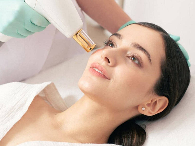 Máy laser trị nám tốt nhất hiện nay - 3