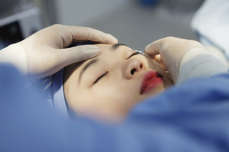 Nhấn mí plasma mang lại hiệu quả cao hơn nhiều so với bình thường