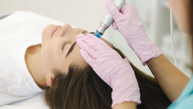 Muốn kết quả cao thì quy trình trị nám phải đầy đủ các bước