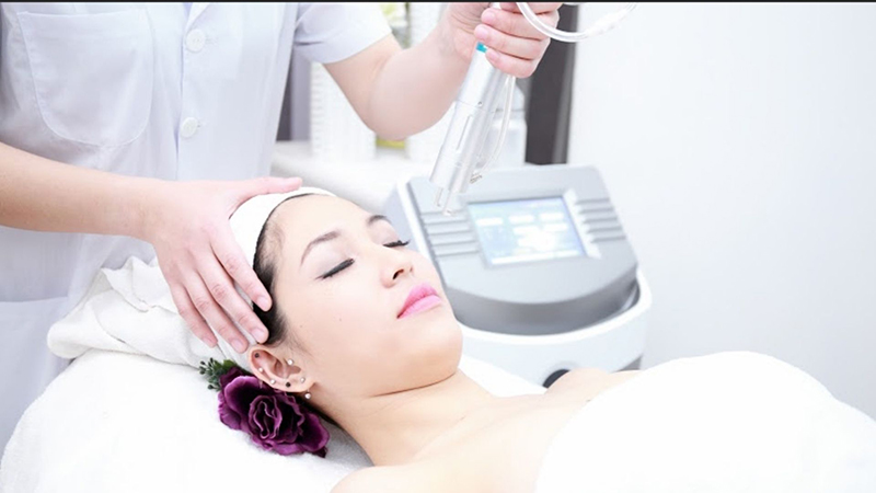 Nên tuân thủ chăm sóc da đúng cách sau khi trị nám bằng laser