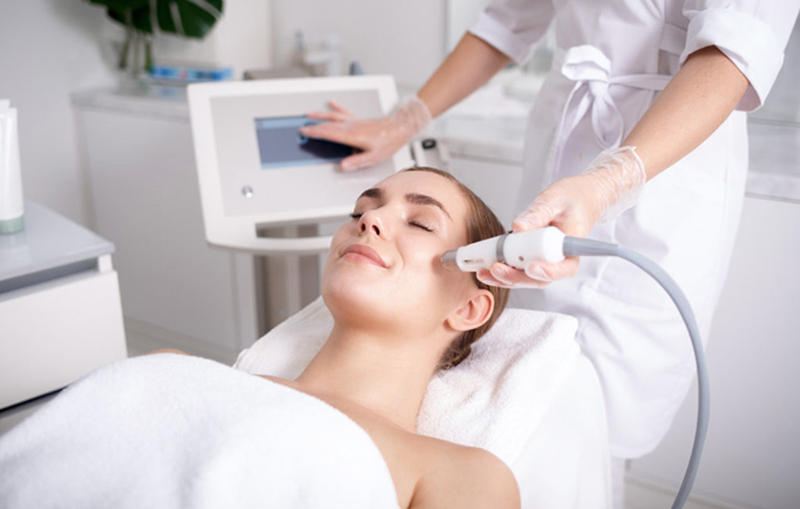 Trị nám bằng laser giúp loại bỏ nám trên 90%