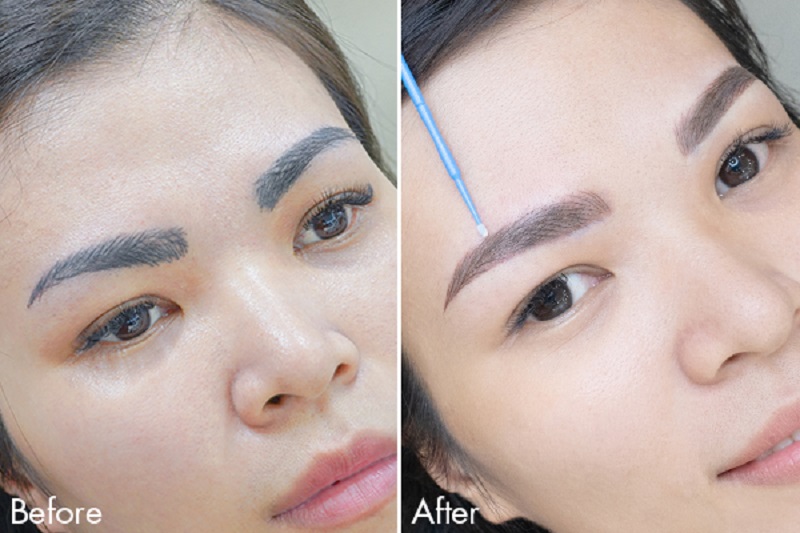 Xóa xăm lông mày có hết hoàn toàn không - 2