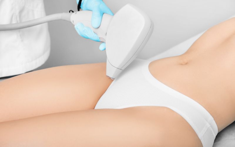 Công nghệ triệt lông hiện đại giúp tiêu diệt tận gốc các nang lông