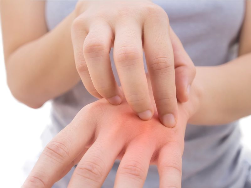 Tiếp xúc hóa chất làm nail nhiều có thể khiến da tay bị kích ứng