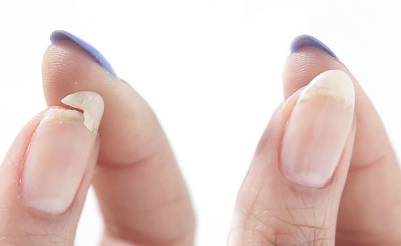 8 Cách Chăm Sóc Móng Tay Tại Nhà Đơn Giản, Hiệu Quả