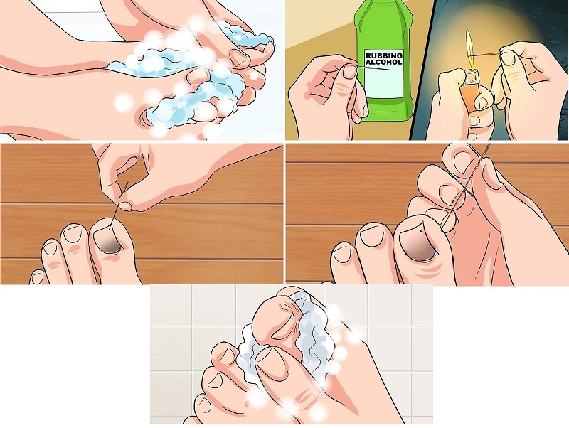 cách dưỡng móng chân bị hư 5