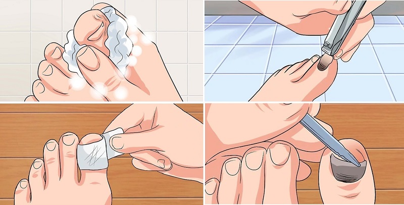 cách dưỡng móng chân bị hư 6