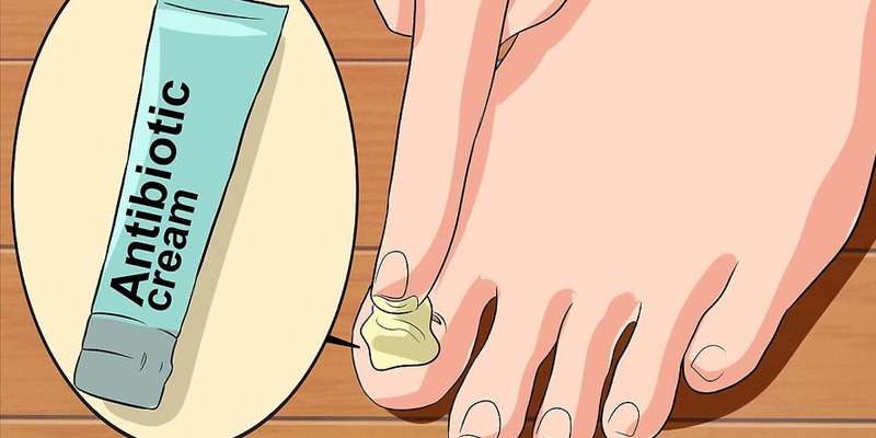 cách dưỡng móng chân bị hư 9