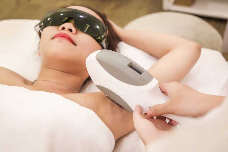 Triệt Lông Nách Có Ảnh Hưởng Gì Không? 1