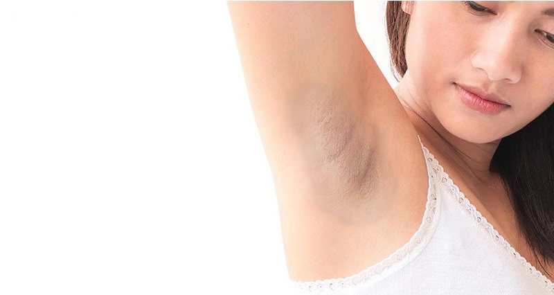 Triệt Lông Nách Có Ảnh Hưởng Gì Không? 2