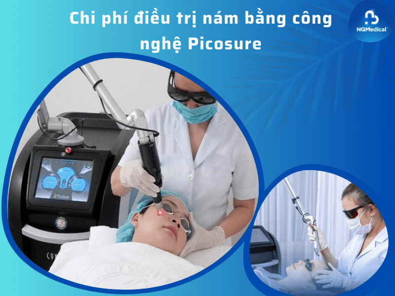Công nghệ trị nám picosure 10