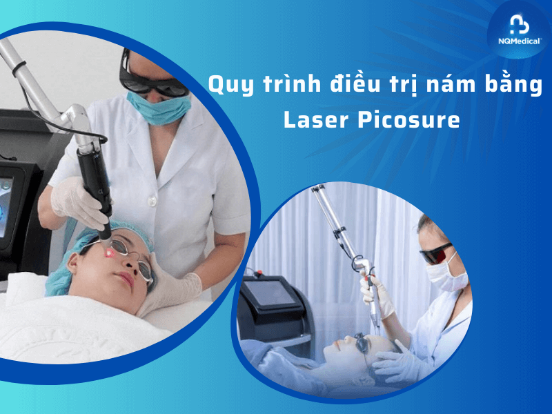 Công nghệ trị nám picosure 9
