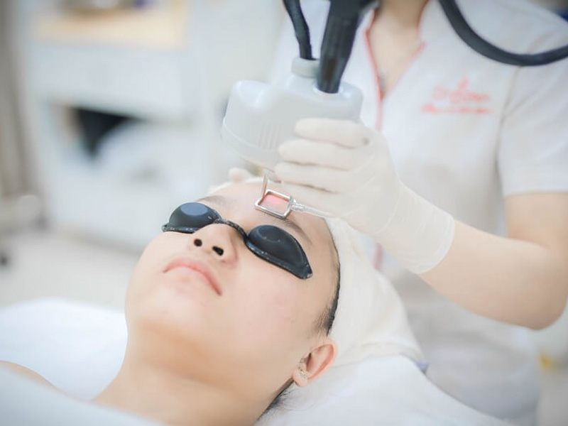 Điều trị sẹo bằng công nghệ Laser Fractional Co2