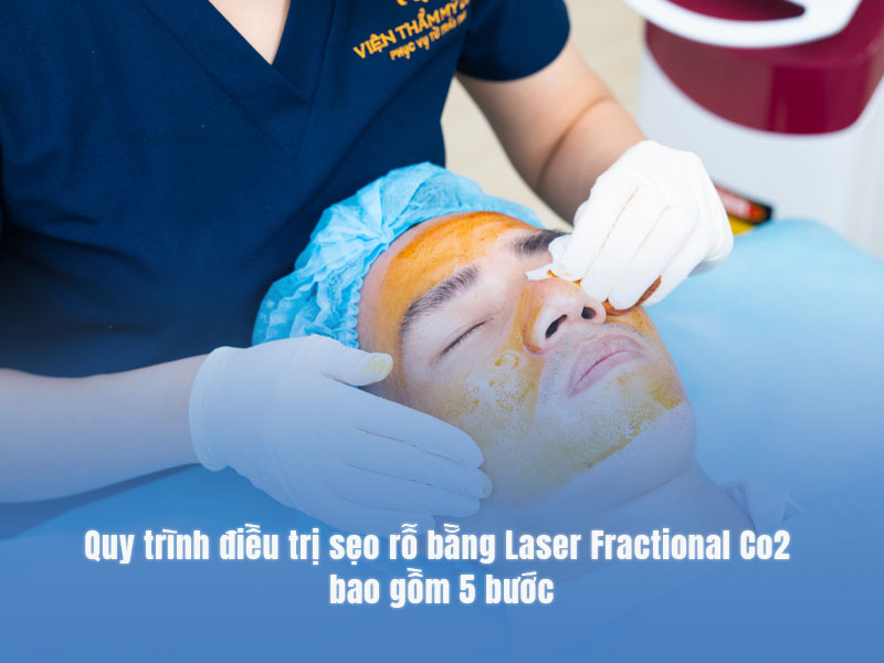 điều trị sẹo rỗ bằng laser fractional co2