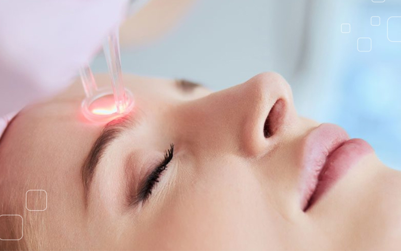 Laser Fractional CO2 giá bao nhiêu 1