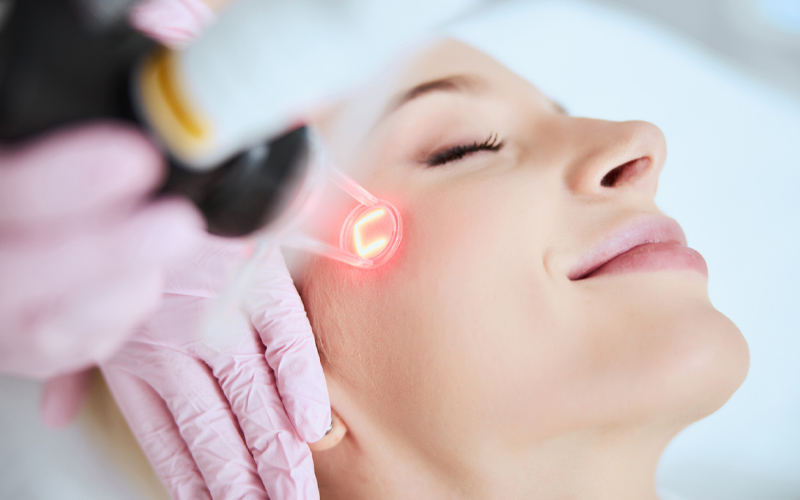 Laser Fractional CO2 giá bao nhiêu 2