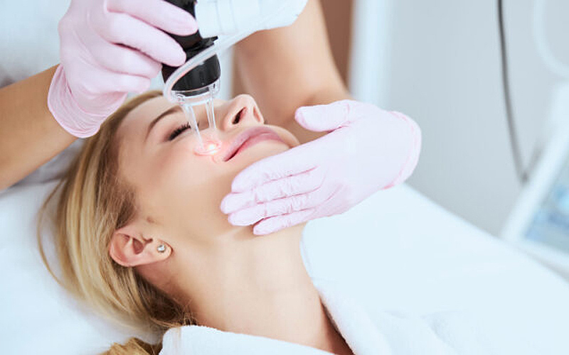 Laser Fractional CO2 giá bao nhiêu 3