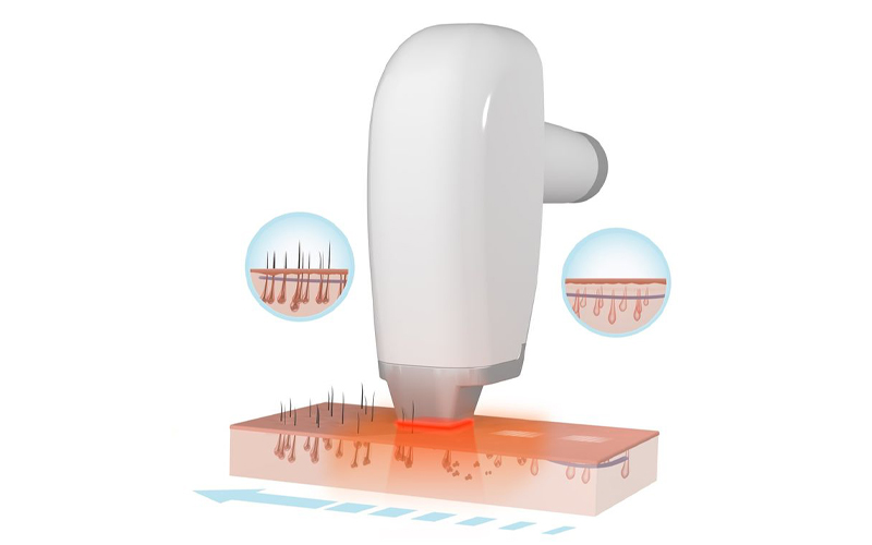 Laser là gì 5