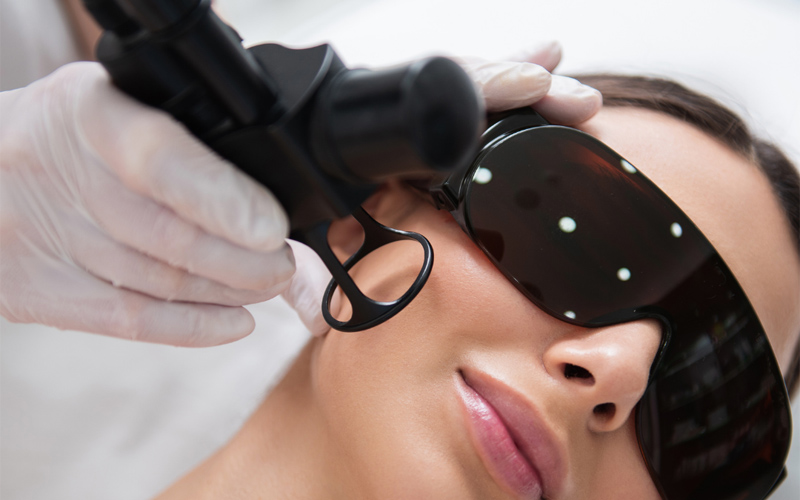Laser Fractional CO2 1