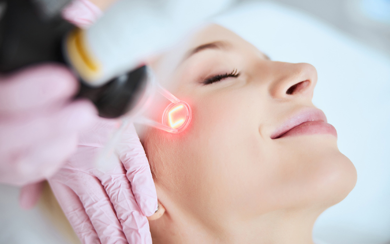 Laser Fractional CO2 3