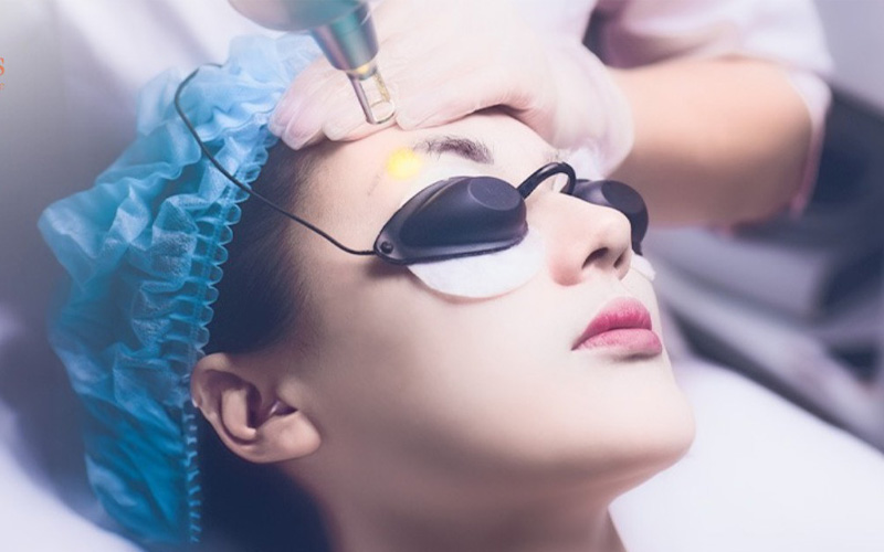 Laser Fractional CO2 6