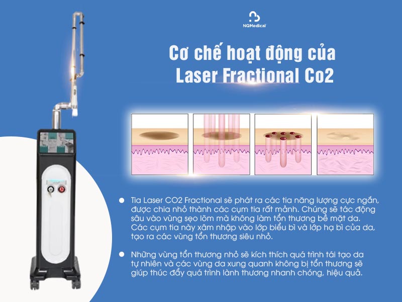 laser fractional co2 trị sẹo lõm 2