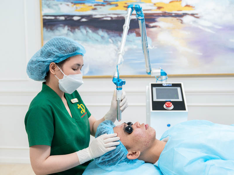 laser fractional co2 trị sẹo lõm 9
