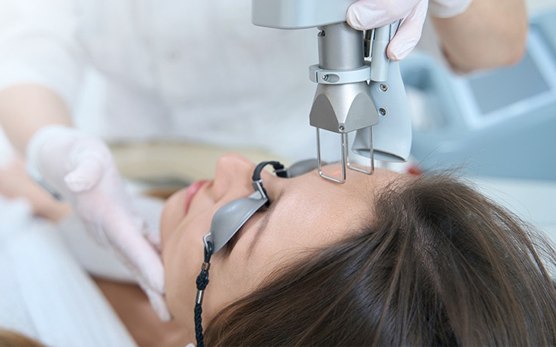 Trẻ hóa da bằng Laser CO2 Fractional 1