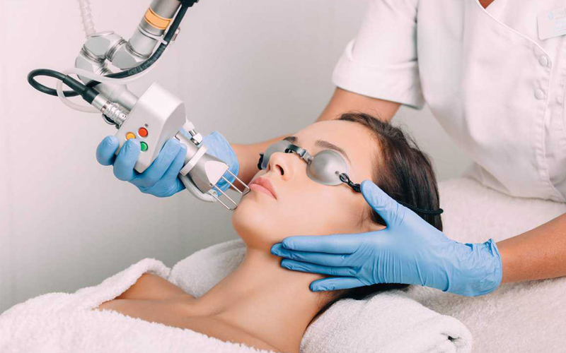 Trẻ hóa da bằng Laser CO2 Fractional 3
