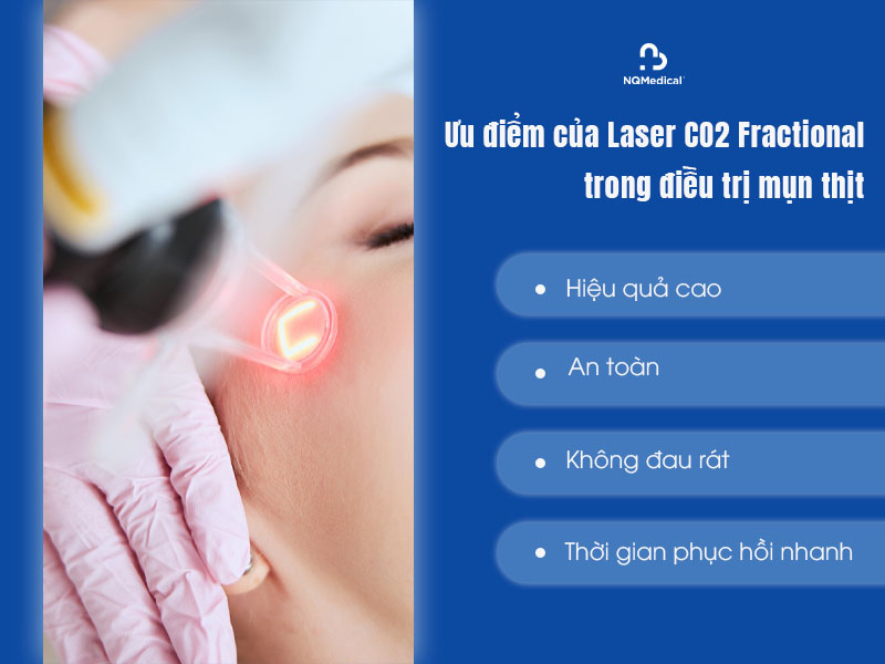 Trị mụn thịt bằng Laser CO2 Fractional