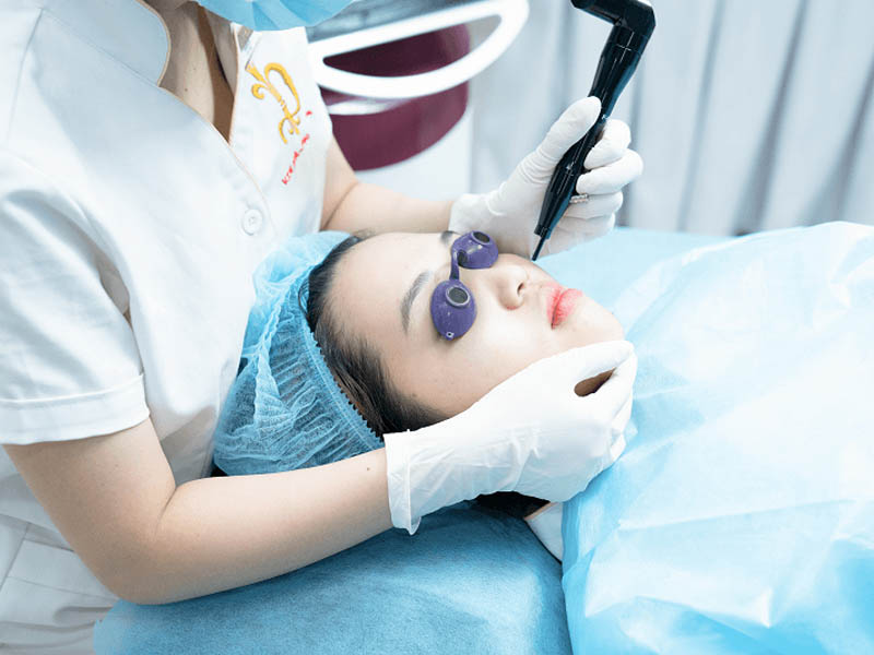 Trị mụn thịt bằng Laser CO2 Fractional