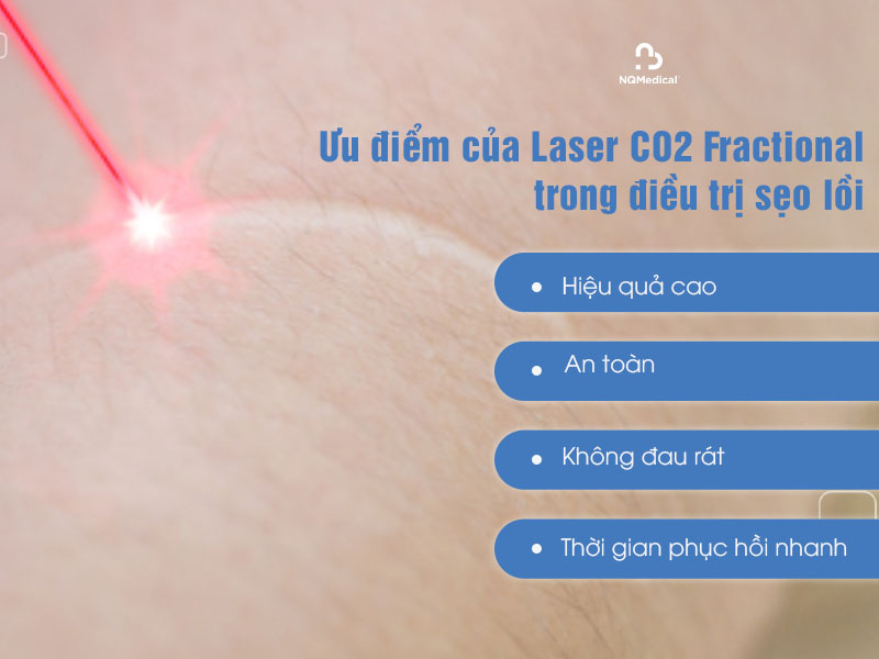 trị sẹo lồi bằng laser co2 fractional 4