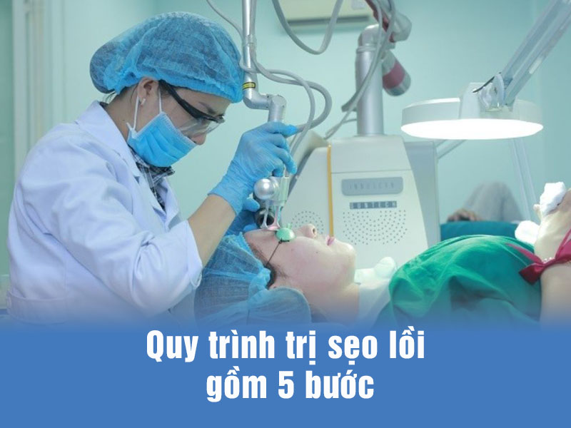 trị sẹo lồi bằng laser co2 fractional 5