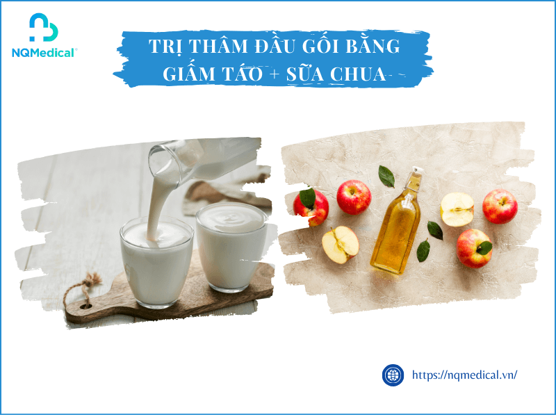 cách trị thâm đầu gối - 12