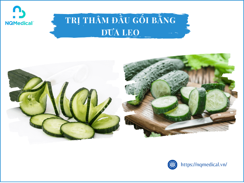 cách trị thâm đầu gối - 14