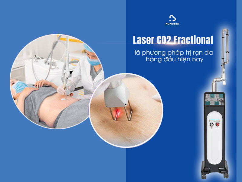laser co2 fractional trị rạn da 2
