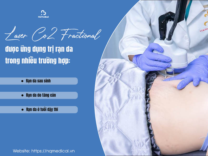 laser co2 fractional trị rạn da 5